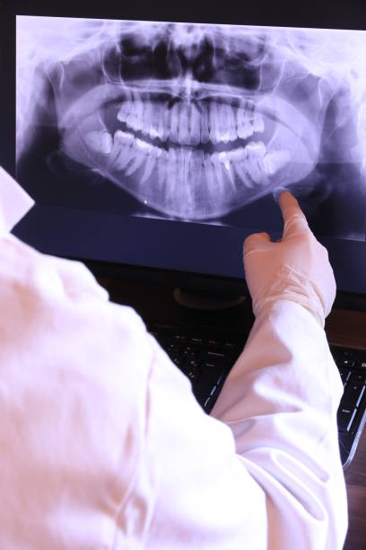 Best Emergency Tooth Extraction in Rutledge, GA